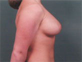 Patient # 23267 After Photo # 2